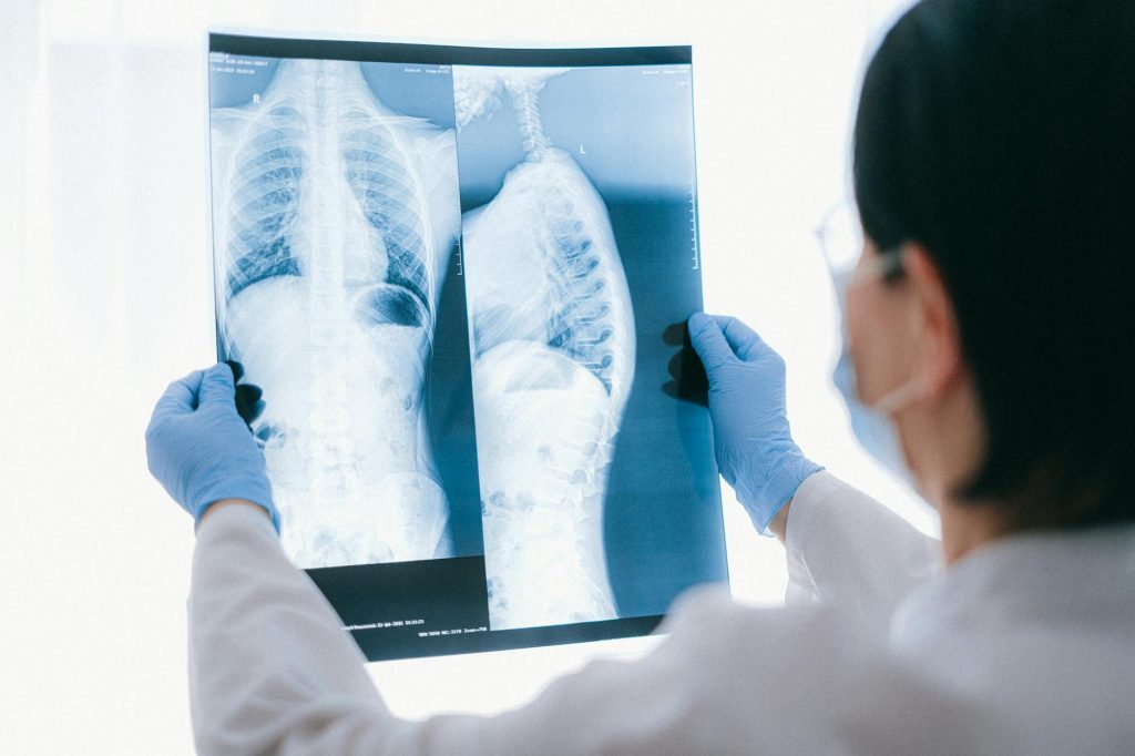 Medical professional analyzing chest x-ray images in a clinical setting for diagnostic purposes.